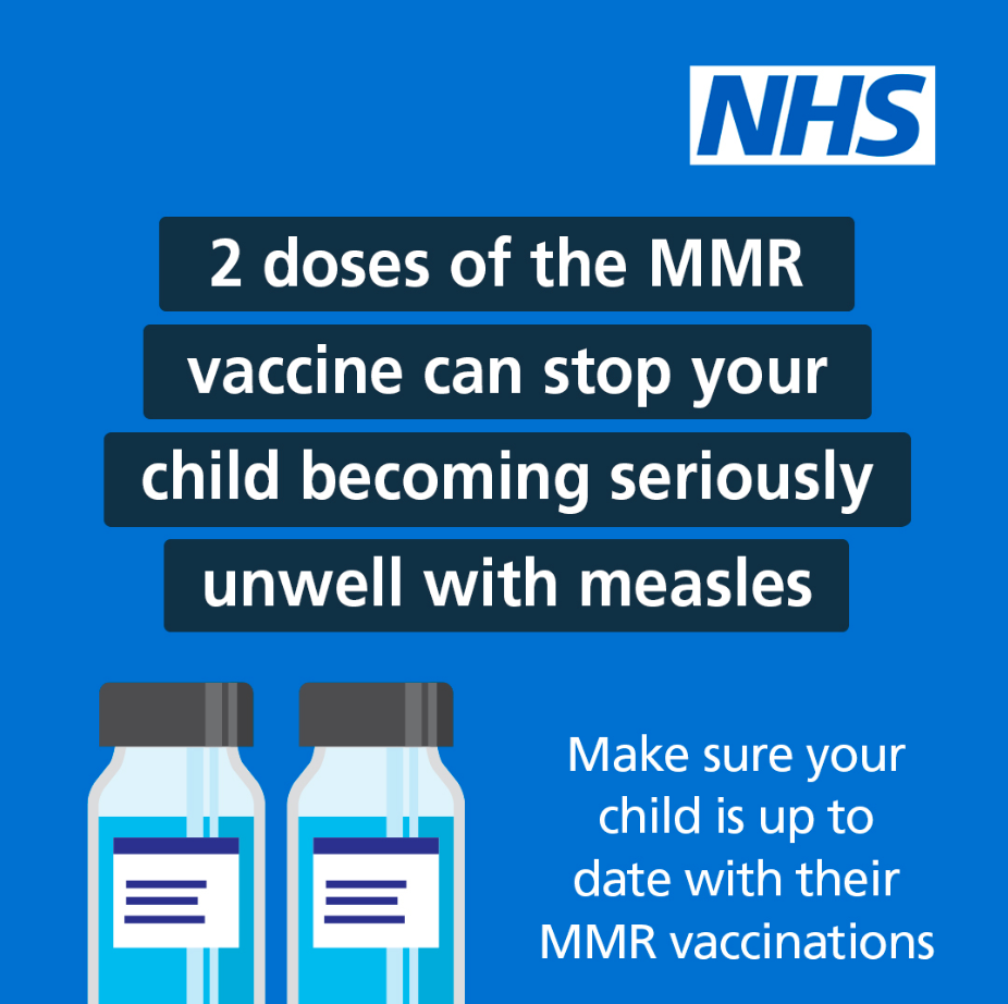 2 doses of MMR.  Full text below